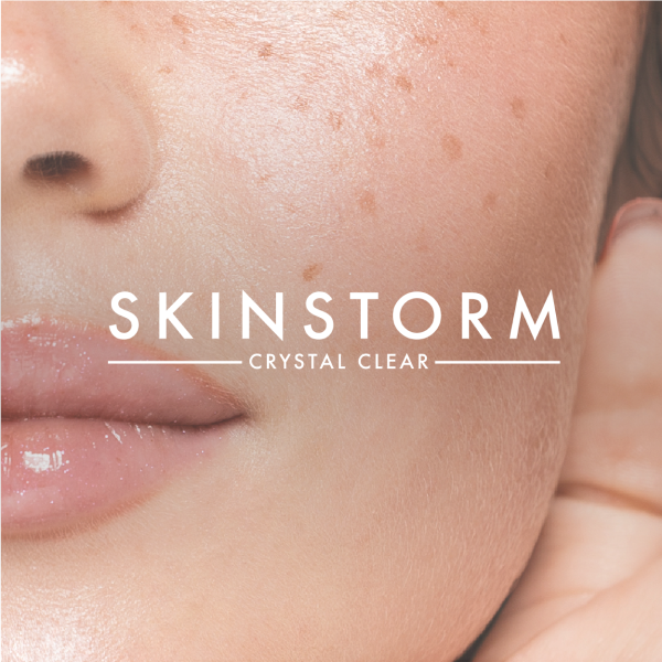 Skinstorm Treatments